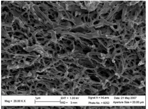 Fig. 2: Real and modeled collagen fiber network