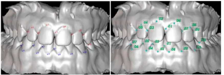 Fig. 3. (left) Virtual 2D picture obtained by 3D model projection on the screen with 3D points  projections (right) dentition 3D model with manually selected 3D points