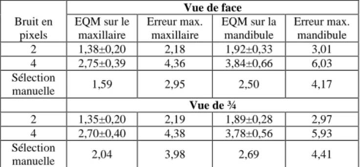 Tableau 1 : EQM de reprojection (en pixels) pour la  méthode WiK pour les 2 points de vue virtuels 