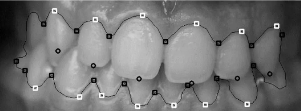 Figure  3.  Three  types  of  points  are  considered  for  matching:  Interstices  points  (black  squares),  Occlusal  points  (black  circles) and Middle points (white square) 