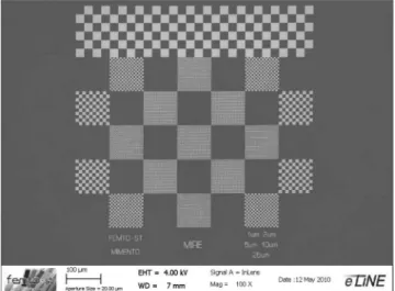 Fig. 1 The distortion phenomenon in image acquisition of a gold on carbon specimen by the JEOL-JSM 820 SEM
