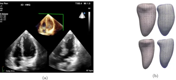 Figure 2: (a) Transthoracic RT3DE. In the figure, the top part depicts the heart tissue in 3D while the two bottom images depict the tissue information on two orthogonal planes