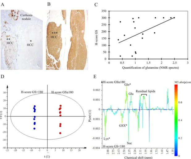 Figure  6.  Glutamine  Synthetase  immuno-staining  and  correlation  with  NMR  data