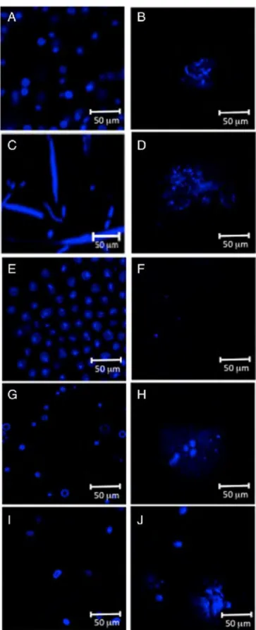 Fig. 2. Confocal laser scanning microscopy offive microalgae before (right) and after (left)  high-pressure cell disintegration
