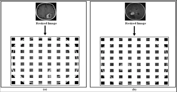 Figure 3. Sixty-four zones obtained after sliding a window of size 16x16 pixels over the MR image: (a) sample 01 of class 02; 