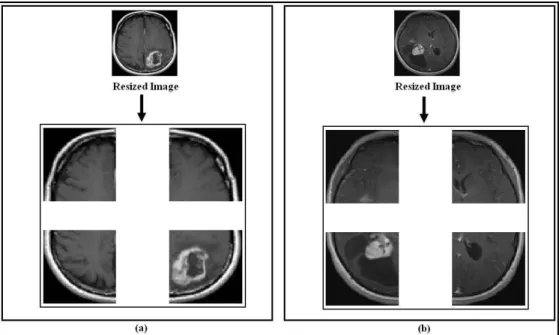 Figure 5. Four zones obtained after the application of the sliding window of size 64x64 pixels: (a) Sample 01 of class 02; (b)  Sample 03 of class 03 
