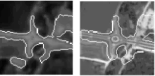 Fig. 4. Mask on Im image and on Ip image after  matching