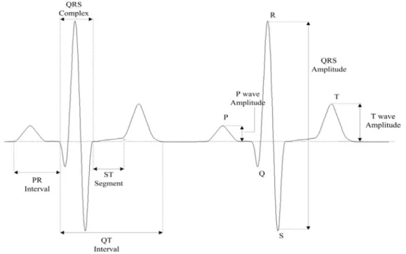 Figure 3.2  Schematic diagram of a typical ECG tracing in normal sinus rhythm.