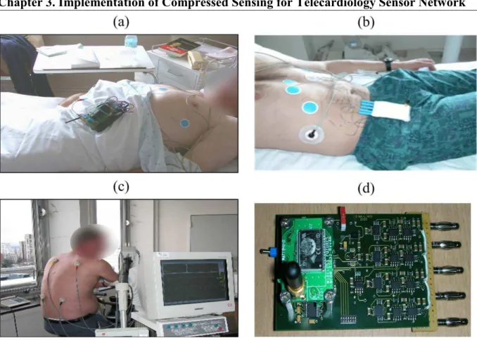 Figure 3.12  Wireless ECG Sensor continuously monitoring the patients suffering from cardiac  arrhythmia.