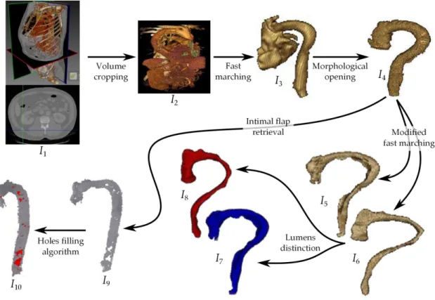 Figure 2 – Aortic dissection segmentation : I 7 false lumen, I 8 true lumen, I 9 intimal ﬂap, I 10 entry tears in red.