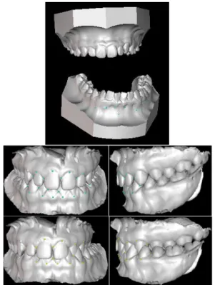 Figure 3 : Repère 3D de reference 