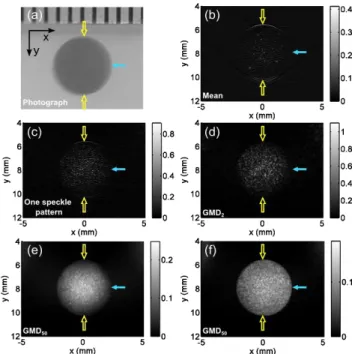 Fig. 2: Images obtained with Phantom 1. (a) Photograph of  the Ø5 mm ink inclusion. A metric ruler was placed on the  top  for  size  reference