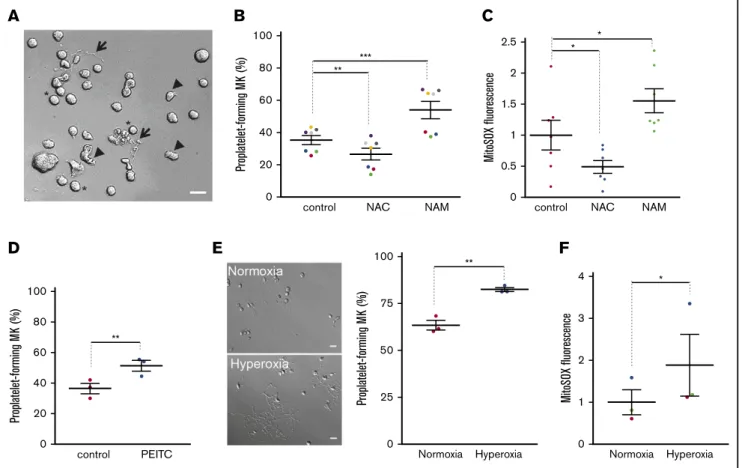 Figure 1. ROS levels regulate proplatelet-forming MKs. Mature MKs were obtained from cord blood CD34 1 progenitors after differentiation for 12 days