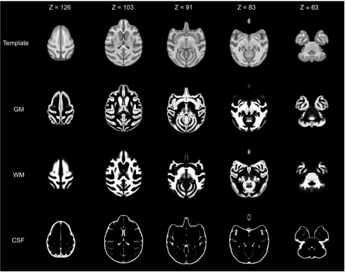 Fig. 3. Template and tissue probability maps. Five axial slices illustrate volume data from Haiko89 (ﬁrst row), the gray matter (GM, second row), white matter (WM, third row) and cerebrospinal ﬂuid (CSF, fourth row)