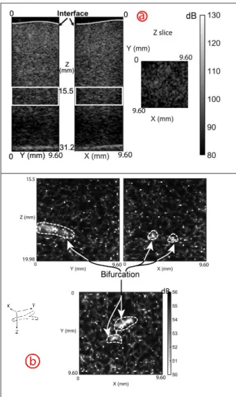Fig 3. Isolated microbubbles in different slices of the volumetric  acquisition. Slices for 3 directions at two different times  a)  Frame  taken  at  t=0