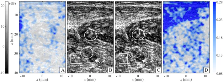 FIG. 6. Aberration correction of in vivo imaging. Before correction, (A) the Strehl ratio map and (B) the confocal image exhibit the consequences of sample-induced distortion