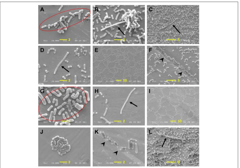 FIGURE 7 | Observation of L. monocytogenes adhesion patterns and cellular morphology. (A–F) Cold-stressed cells; (G–K) cold-adapted cells; (L) positive control cells