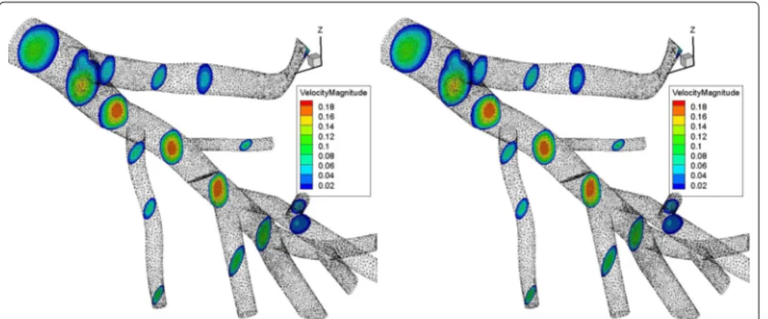 Figure 6 Velocity profiles in the hepatic vein. Velocity profiles at different cutting planes in hepatic venous network when acoustic streaming effect is either computed (left) or not (right).
