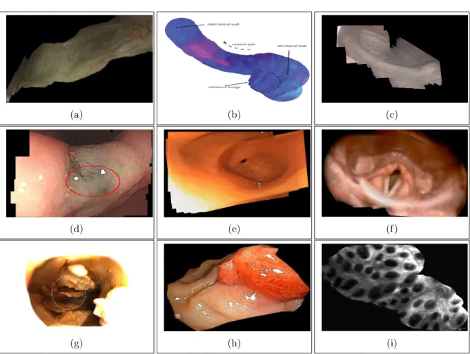 Figure 1.6: Image mosaics obtained for different endoscopic applications given in Fig