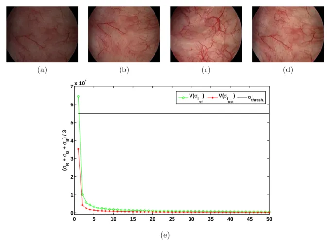 Figure 1.9: Contrast enhancement in cystoscopic image sequences. (a) poor contrast image (I test ) due to view-point, b) target image to which image in (a) need to be registered, c) reference image (I ref ), d) enhanced image (I enhanced ), (e) Singular va
