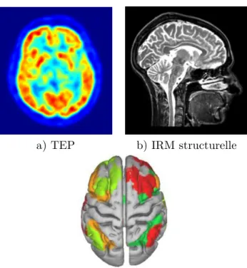 Figure 1.1 – Visualisation du cerveau humain à l’aide de différentes techniques d’imagerie.