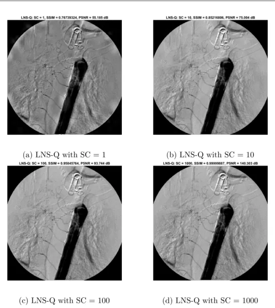 Fig. 3.17 Comparison between the visual effects with LNS-Q with different SC .