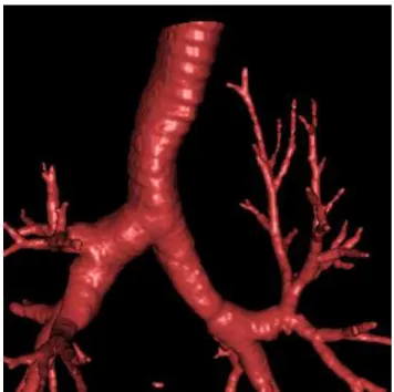Figure 2: Three-dimensional reconstruction of the proximal part of the tracheobronchial tree.