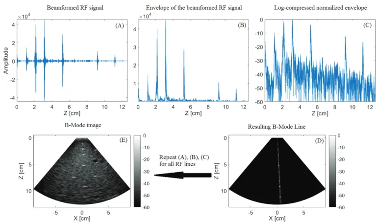 Fig. 13. Obtaining a B-Mode image:   The RF signals resulting from one transmission event are  beamformed (A)