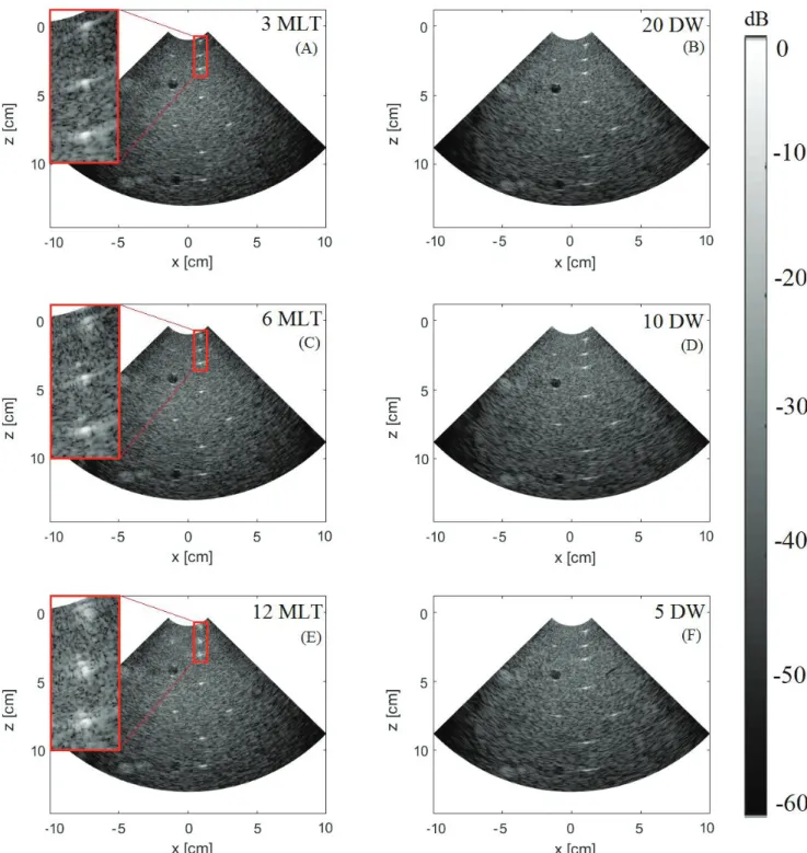 Fig. 30. Image quality for MLT (left column) and DW (right column) by using a frame rate of 225 Hz  (A), (B), 450 Hz (C), (D), and 900 Hz (E), (F)
