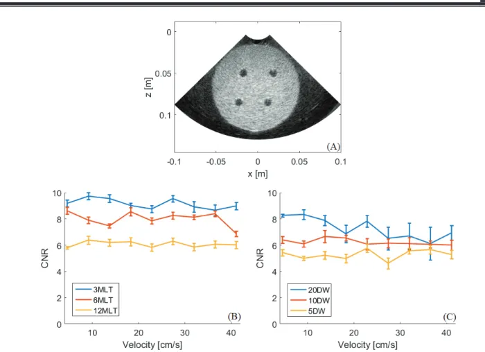 Fig. 32. CNR at different velocities of the disk calculated on the phantom showed in (A)