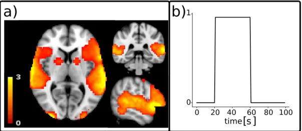 Figure 4.3 shows examples of recovered spatial maps (Figure 4.3.a) and time series (Figure 4.3.b) using the PF-fMRI ( ˆu PF− f MRI ) and the TA ( ˆ u TA )