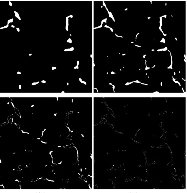 Figure 4.13: Binary sparse bone reconstructed images and difference maps with σ p = 3 and M=20 projection angles and 729 X-rays per projection.