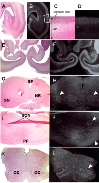 Figure 4 SLC25A22 gene expression in the 15-wk-old (A–F) and 20-wk-old (G–L) fetal human brain
