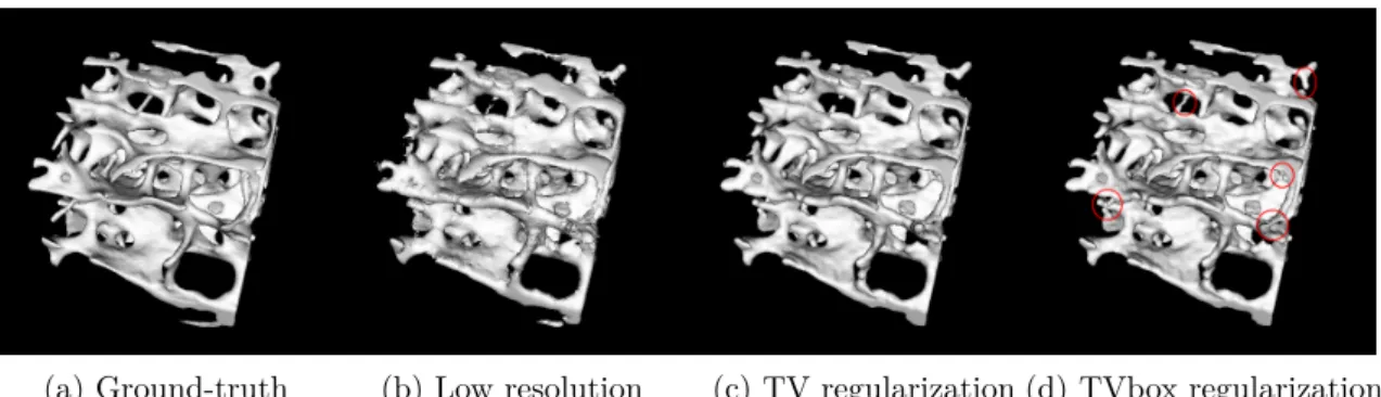 Figure 1: Comparison of 3D restoration methods for the noise level sigma=0.1.