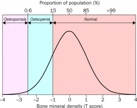 Figure 1.9: Distribution of bone mineral density in healthy women aged 30-40 years [Kanis (2002)]