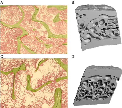 Figure 1.13: A typical pre- and post-menopausal bone biopsy; histomorphometry (A and C) and micro-CT scan (B and D) from a single subject is shown