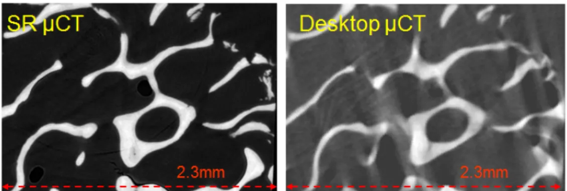 Figure 1.16: A comparison of a slice of the same biopsy sample using a SR micro-CT (left) and a Desktop micro-CT (right) [Nuzzo et al