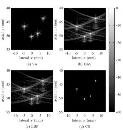 Figure 5 – Résultat de [Schiffner et al., 2012] obtenus a partir d’un fantôme contenant quatre diffuseurs isolés