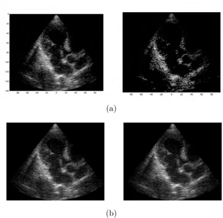 Figure 6 – (a) Résultats de [Wagner et al., 2012] : image originale et image obtenue par CS avec optimisation l 0 