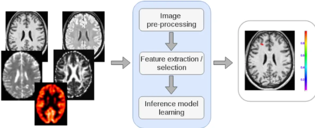 Figure 1.2: A CAD system for neuroimaging. Input: multimodality neuroimaging data.