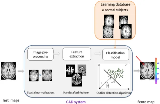 Figure 4.1: General representation of the CAD system by [El Azami et al., 2016]. The framework consists of three major steps - 1