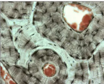 Figure 1.10 Light microscopy. Haversian canals and the osteocyte system from the transverse  section of human phalanx [Marenzana et al