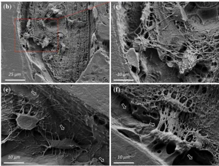 Figure 1.12 Scanning electron microscope. Osteocytes and canaliculi located in a large autogenous  bone fragment [Shah et al