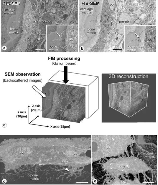 Figure 1.17 Serial backscattered images and 3D reconstructions of osteoblasts and osteocytes  located in the metaphyseal trabeculae by FIB-SEM observation [Hasegawa et al