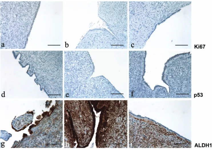 Figure 1. Ki67, p53 and ALDH1 immunoreactivity in ovary; left column, after treating with tamoxifen; center column, after treating with clomid; right column, untreated control group