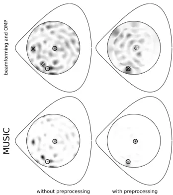Figure 5 shows the probability of localization of 4 sources for OMP and MUSIC as a function of the number of  mea-surements and of Fourier-Bessel functions used to capture the reverberation