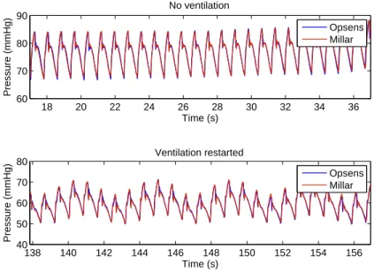 Figure 2: Opsens and Millar pressure signals