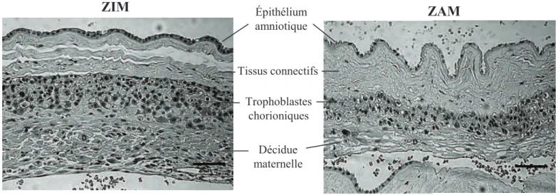 Figure 9: Comparaison histologique des zones ZIM et ZAM des membranes fœtales humaines