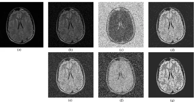 Fig. 4.8 – L’image m´ edicale avec le bruit Gaussien et les r´ esultats de segmentation (c=3).