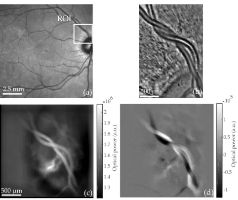 Fig. 4. An artery intertwined with a vein is imaged with commercialized instruments and Laser Doppler holography.(a) Scanning laser ophthalmoscope (Spectralis, Heidelberg)